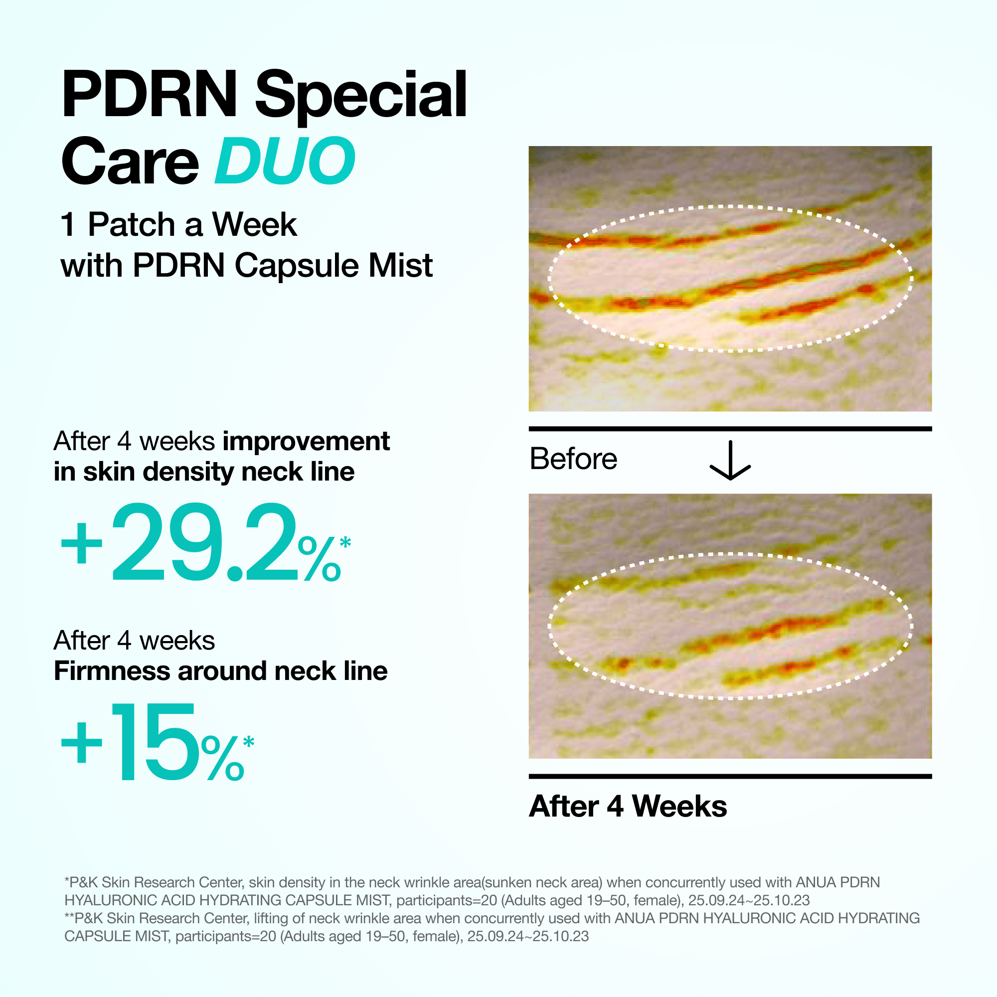 Anua US Spot Patches PDRN COLLAGEN MELTING PATCH FOR NECK 4ea