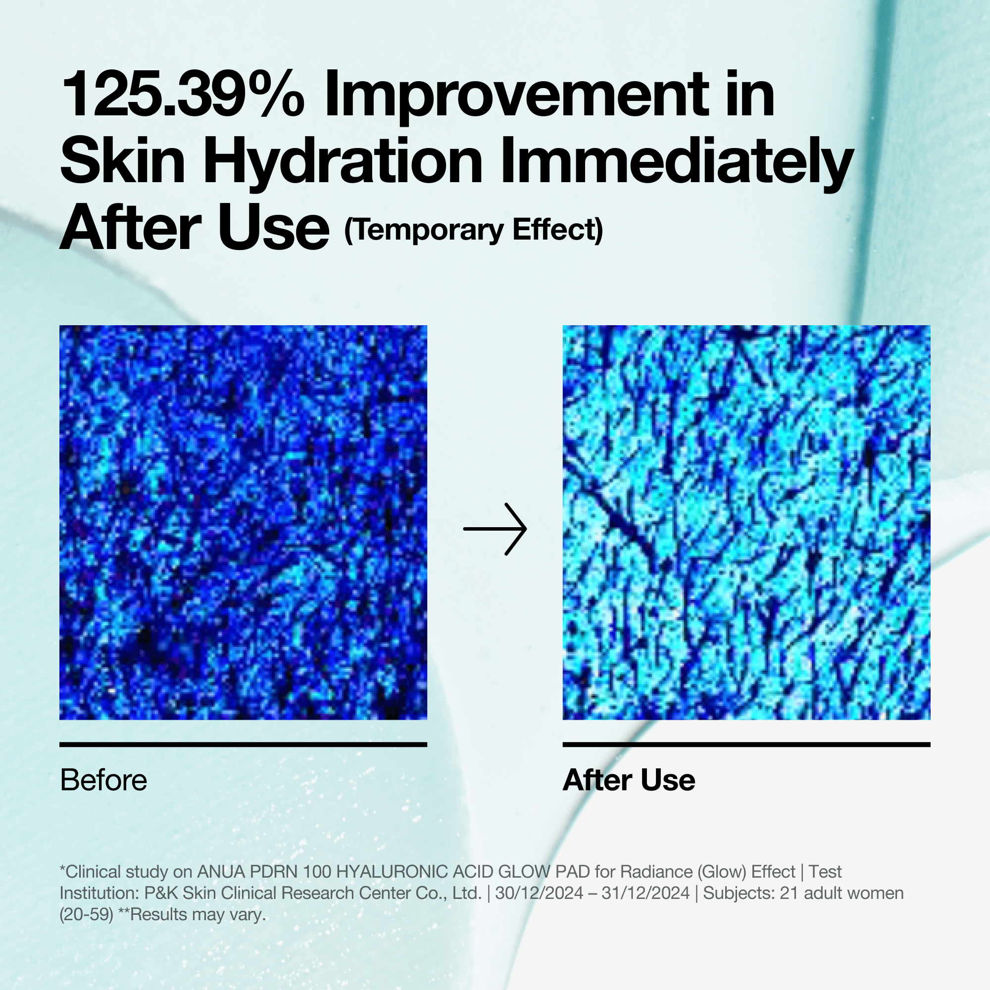 Anua US Toner 60 ea PDRN 100 Hyaluronic Acid Glow Pad