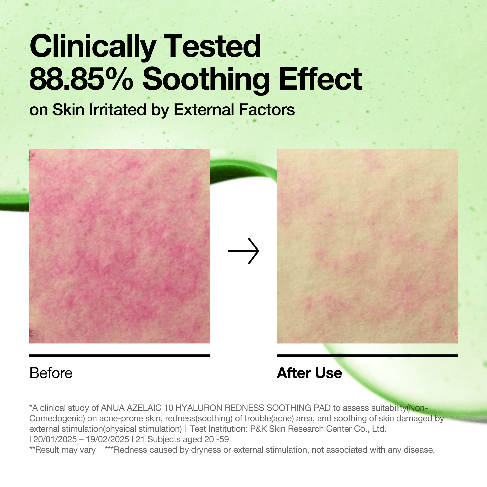 Anua US Toner 90 ea Azelaic 10 Hyaluron Redness Soothing Pad