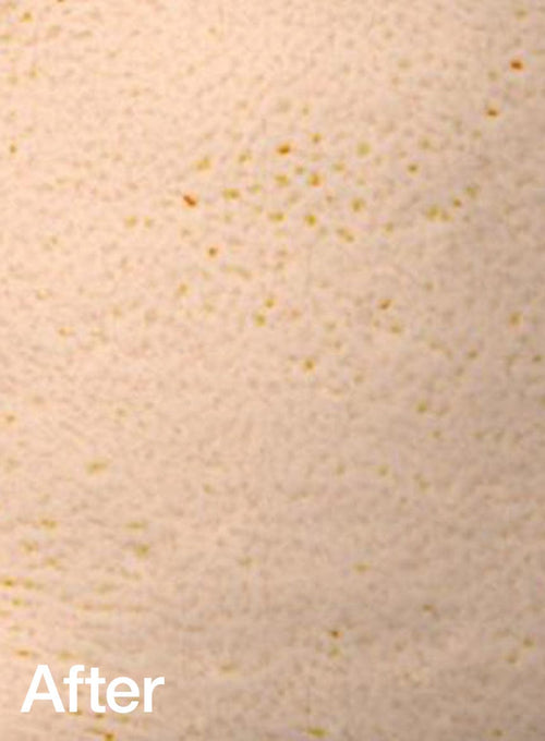 After Before shrinking the pores
