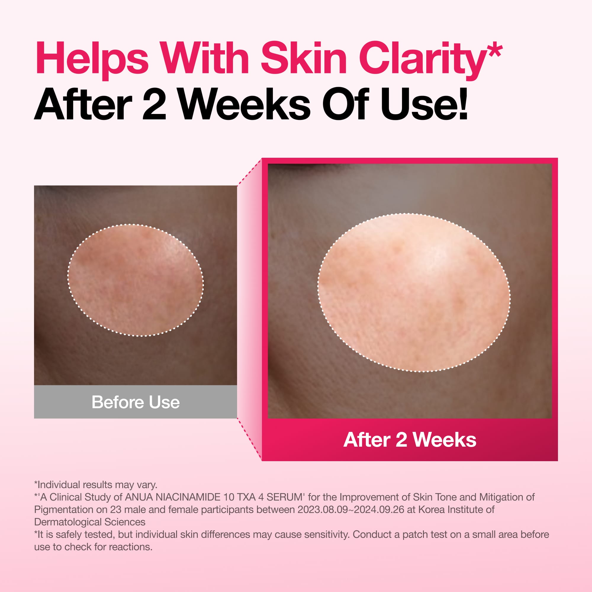 Niacinamide 10% + TXA 4% Dark Spot Corrector Serum | Anua