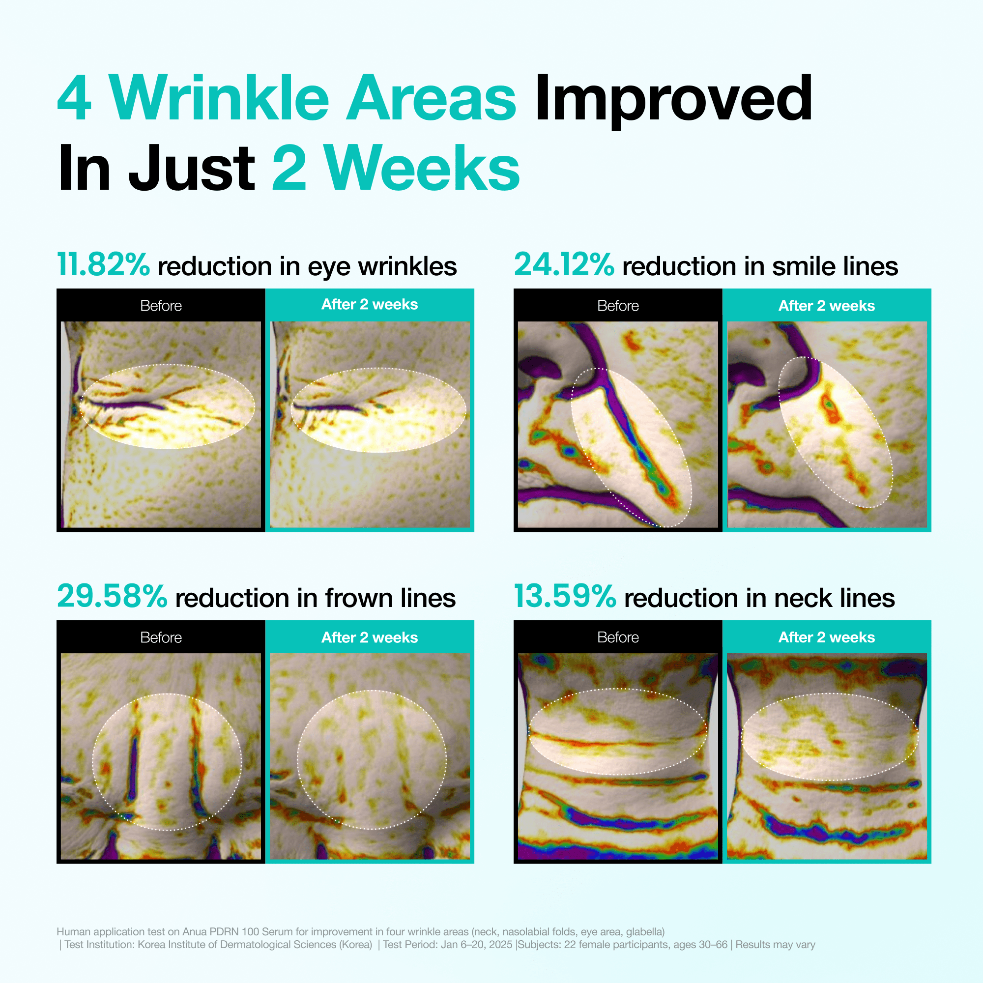 Anua US Bundle 2-Week Wrinkle-Out Routine Set [First 100 Only] 2-Week Wrinkle-Out Routine Set