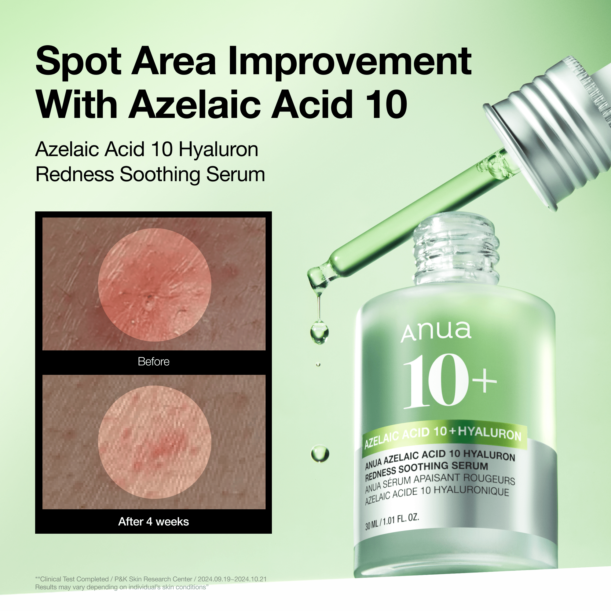 Anua US Bundle Breakout Care Routine Set [44%] Breakout Care Routine Set