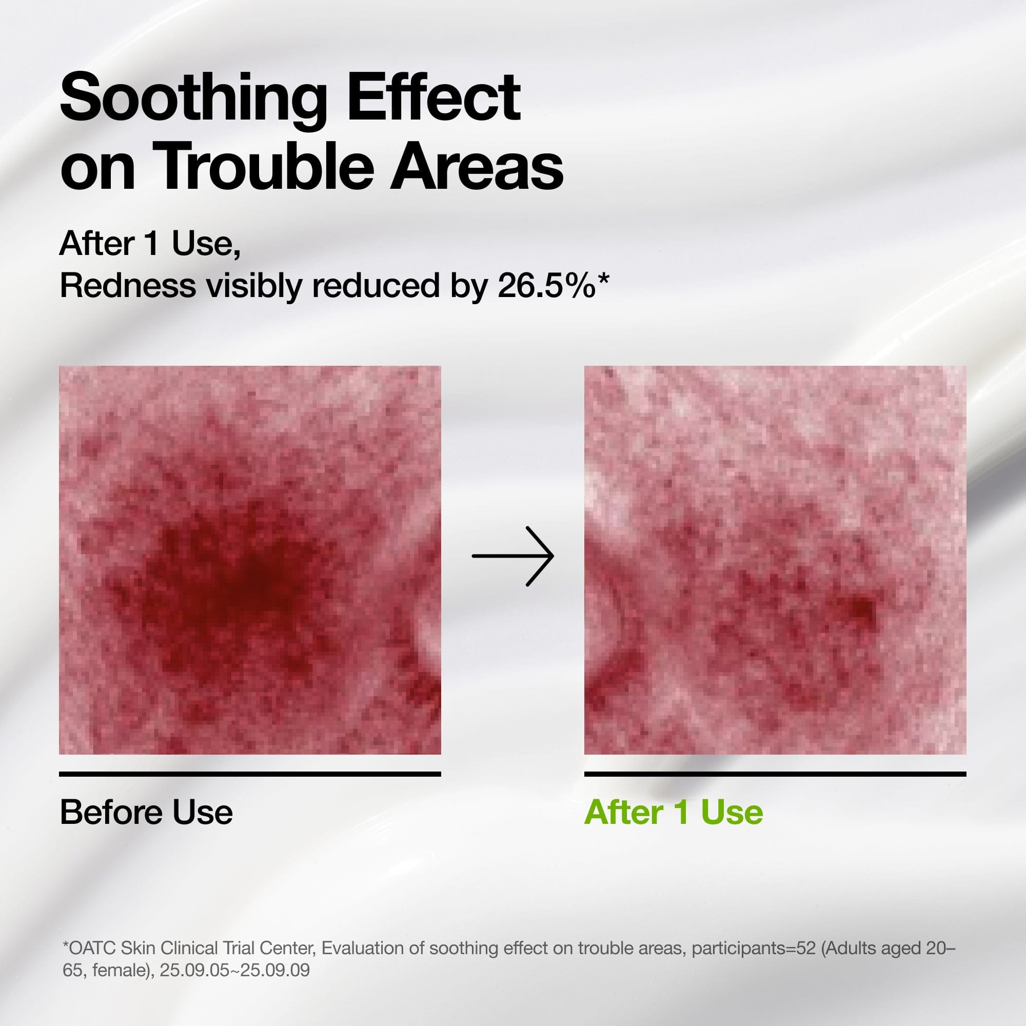 Anua US Moisturizer Azelaic Acid CICA Skin Soothing Moisturizer