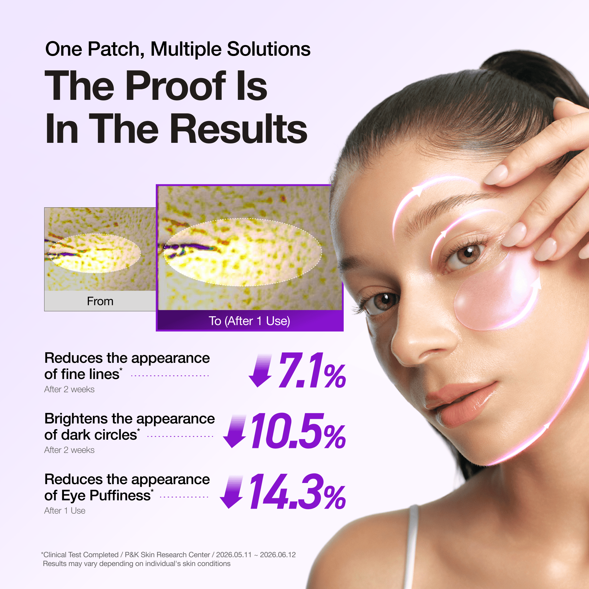 Anua US Spot Patches Retinol Berry Revitalizing Eye Patch