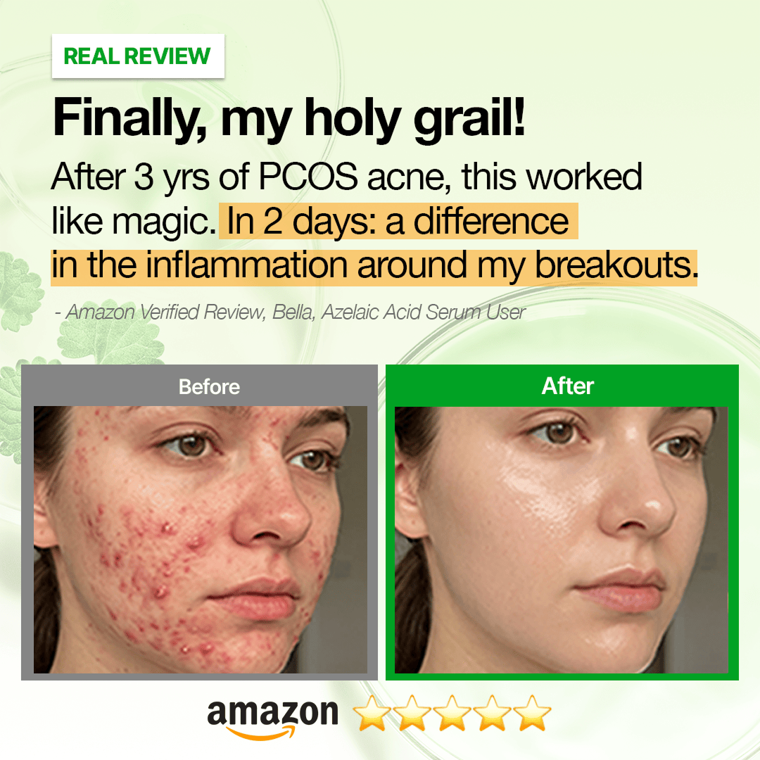 Hidden [Amazon No.1🏆] ANUA Breakout Control Serum