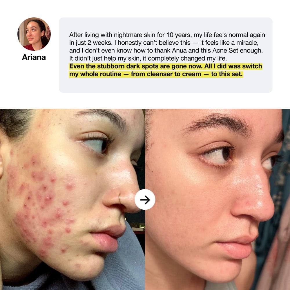 Hidden Bundle Acne&Dark Spot Care Set Acne&Dark Spot Care Set