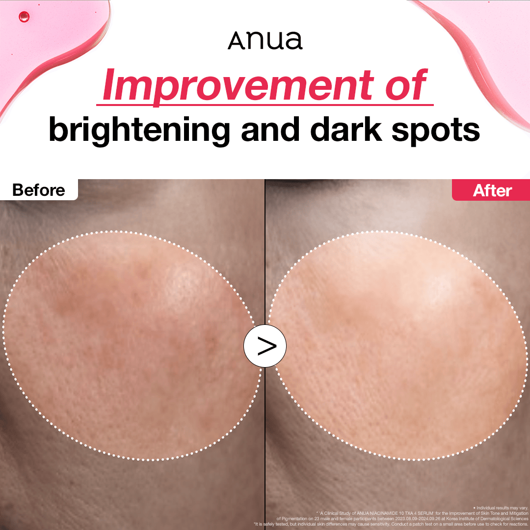 Hidden Niacinamide 10 TXA 4 Serum for Brightening and Dark Spots [Amazon Best-selling] Dark Spot Serum
